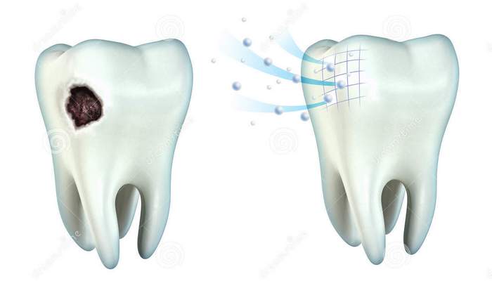 Стоматология 4 teeth cavity 22840557